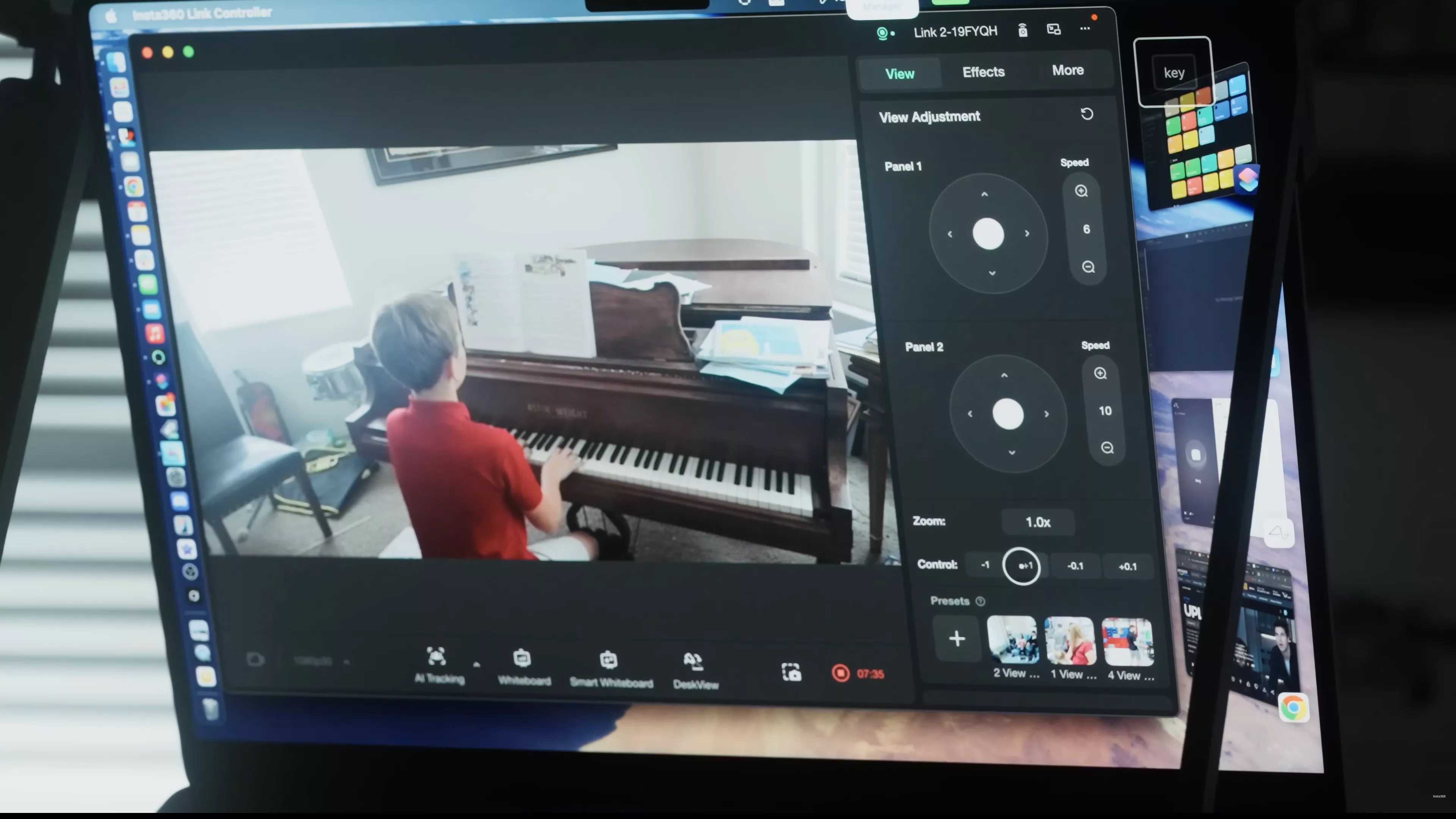 neuralink-implanti-als-hastasina-yeniden-etrafina-bakma-yetisi-kazandirdi-0-n4LflYcq Neuralink implantı ALS hastasına yeniden ‘etrafına bakma’ yetisi kazandırdı