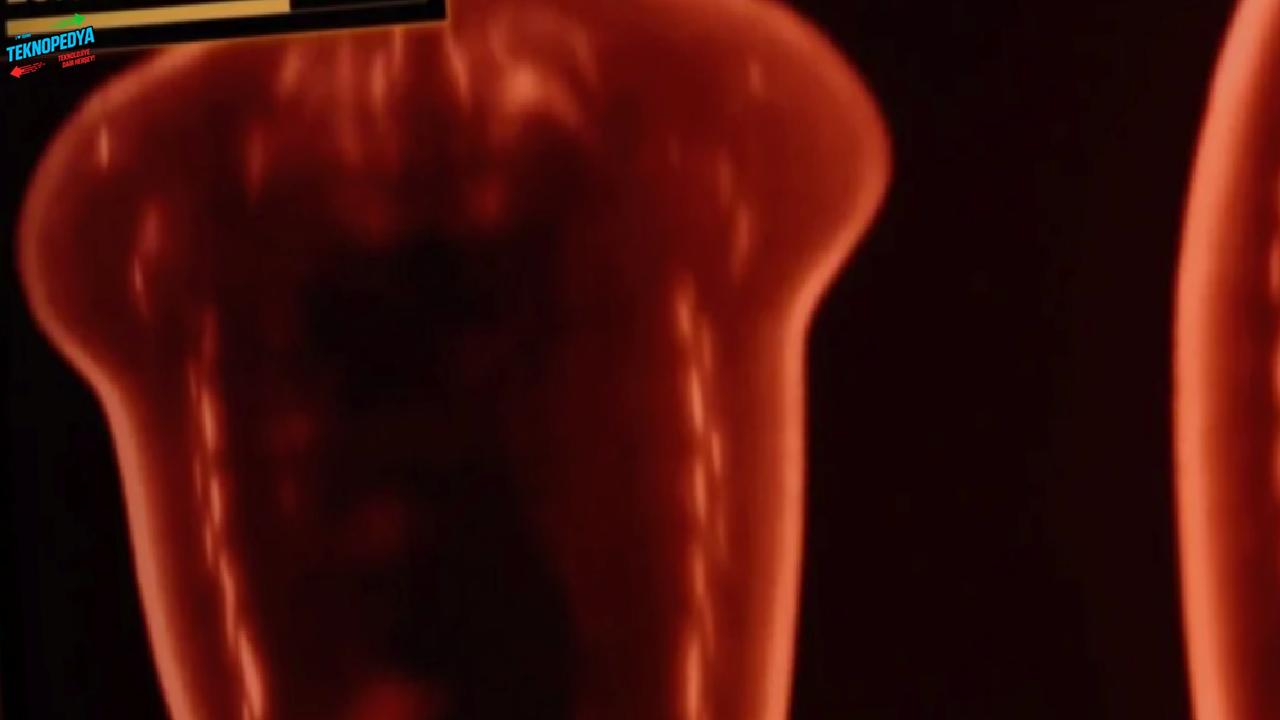 Yapay zekanın yeni çılgınlığı: Havuzda ultrason taraması