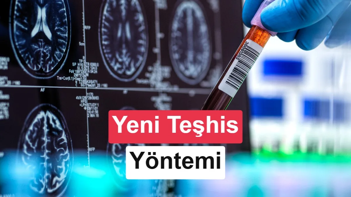 Alzheimer Tanısında Kan Testleriyle Yeni Dönem: FDA’dan İki Arka Arkaya Onay