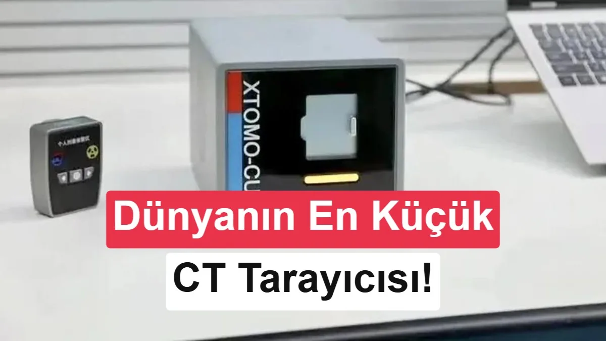 Çinli Araştırmacılar, Xtomo-Cube ile Dünyanın En Küçük CT Tarayıcısını Tanıttı