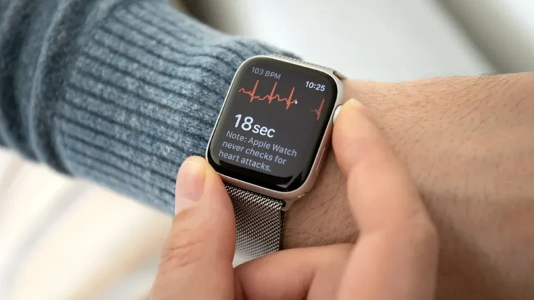İkinci el Apple Watch alırken dikkat etmeniz gerekenler