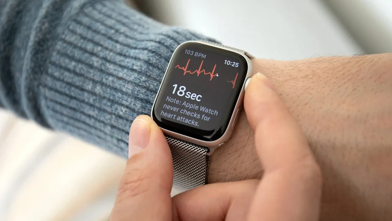 İkinci el Apple Watch alırken dikkat etmeniz gerekenler